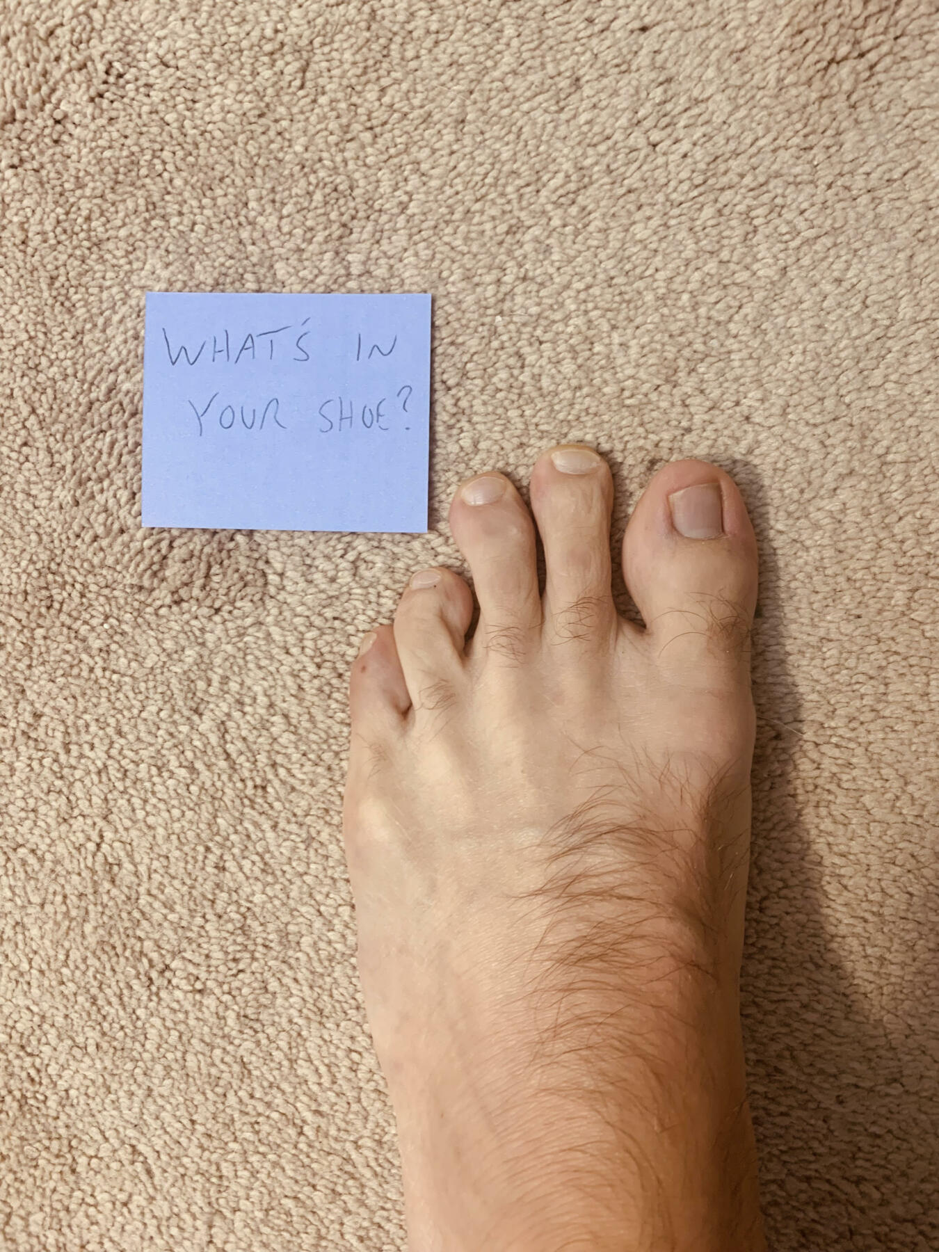 Todd's foot